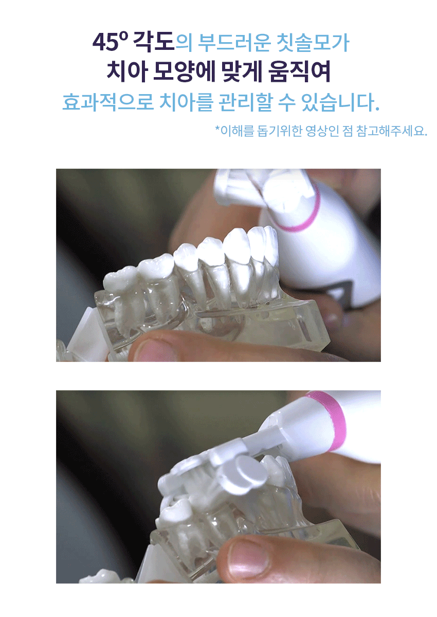 트리플 브리스틀 치과의사가 만든 3중모 자동칫솔 3단계 음파 전동칫솔 세트 상세이미지