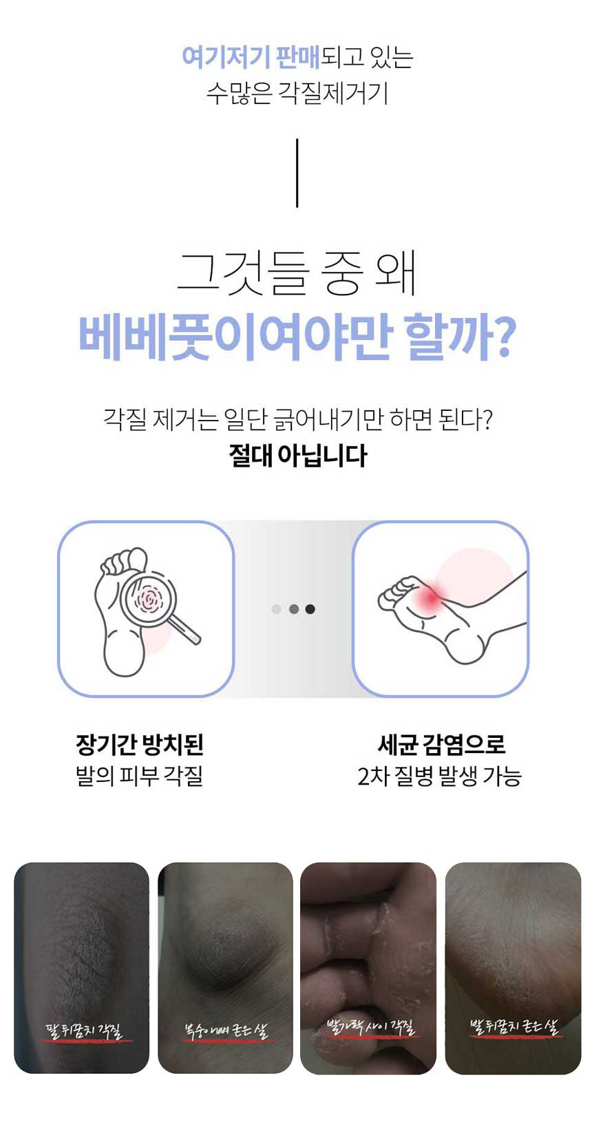 [베베풋] 글라스 에어 발 각질제거기 각질제거 BF-008 상세이미지